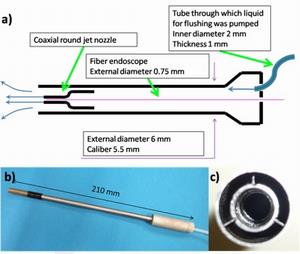 endoscope.jpg